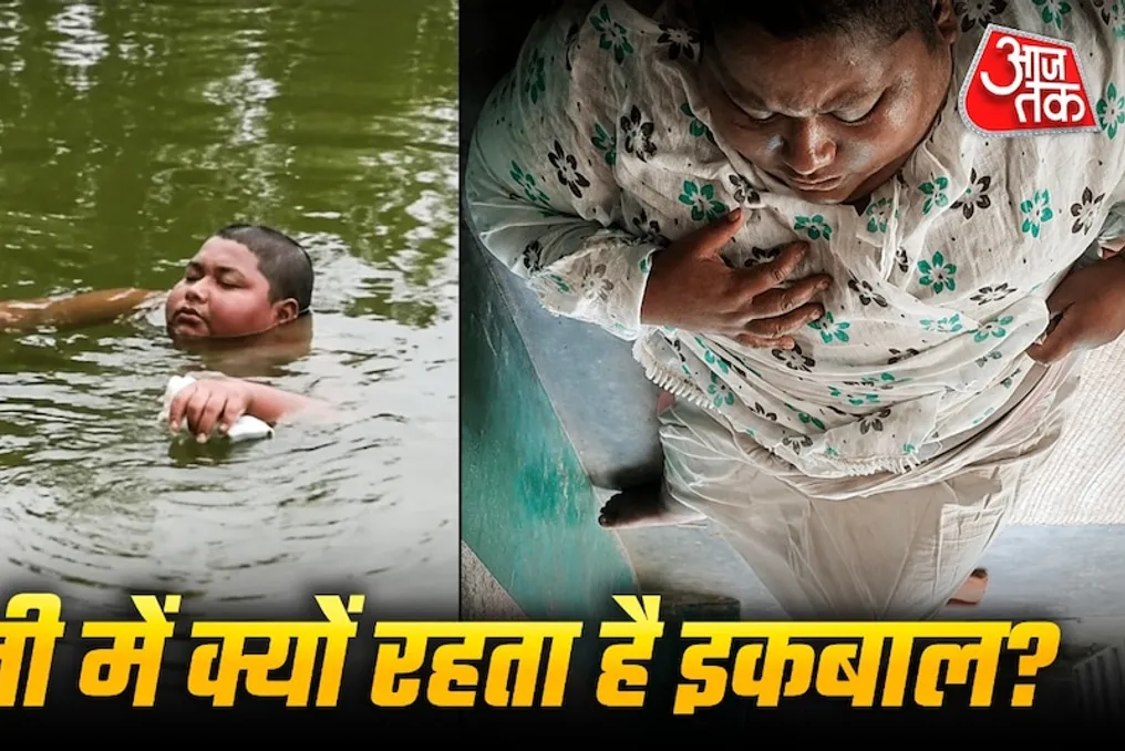Doctor explains why 16-year-old Iqbal is constantly in water: it's a treatable illness