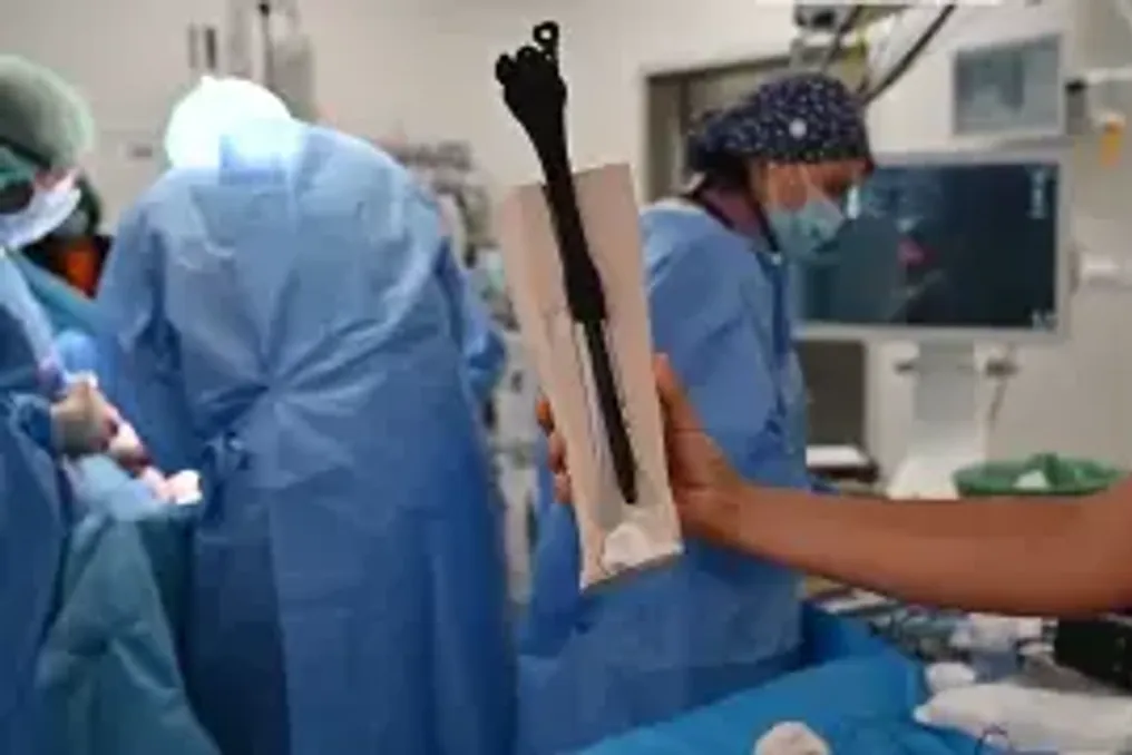 Prótese 3D aplicada em Madri em vez de osso, salvando a perna de um paciente
