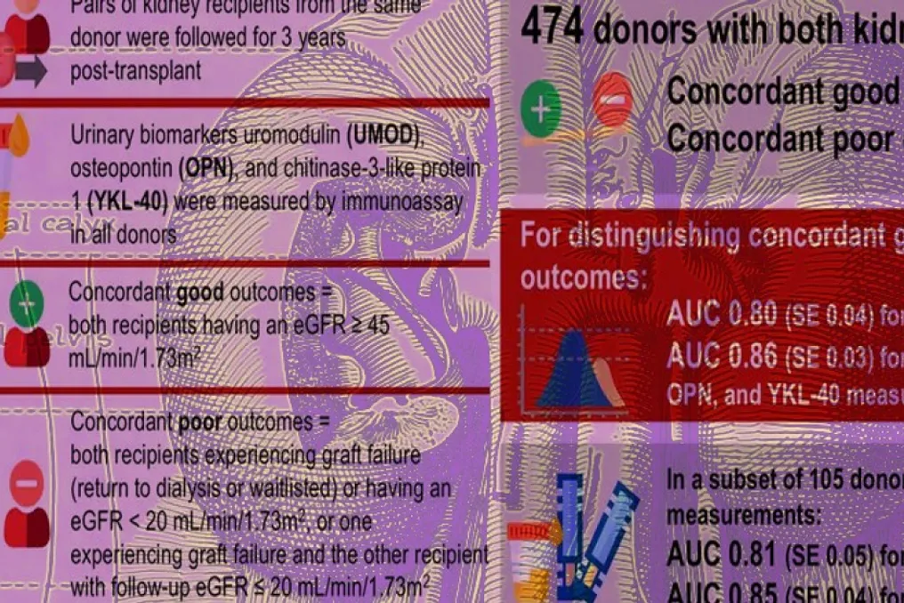 Estudo mostra que a análise de biomarcadores na urina do doador aumenta a precisão da avaliação renal para transplante