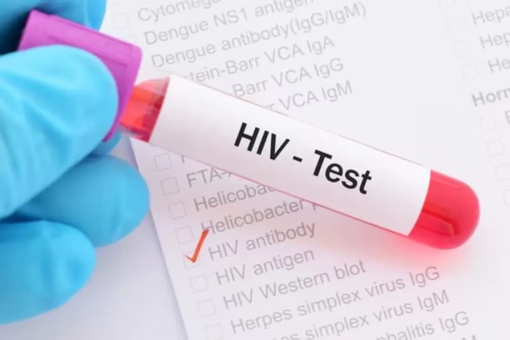 Woman with HIV discovered in Barabanki prison; department begins contact tracing