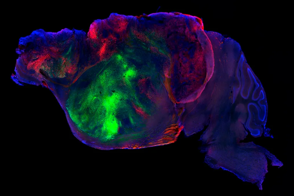 Scientists create mice with human brain cells for new neurological studies