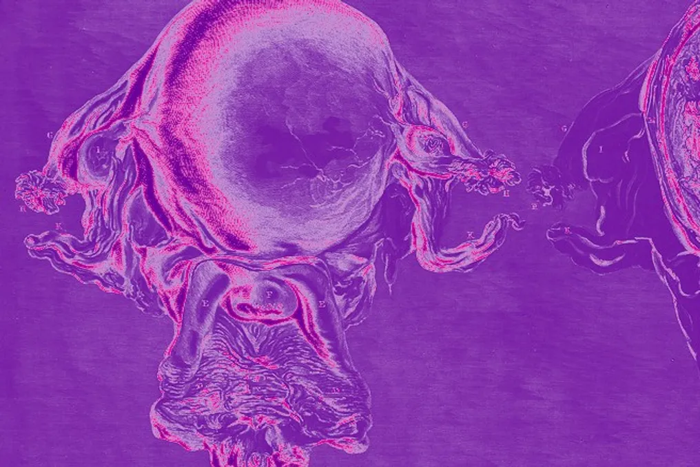 Study shows that 70% of women who underwent uterine transplants were able to give birth