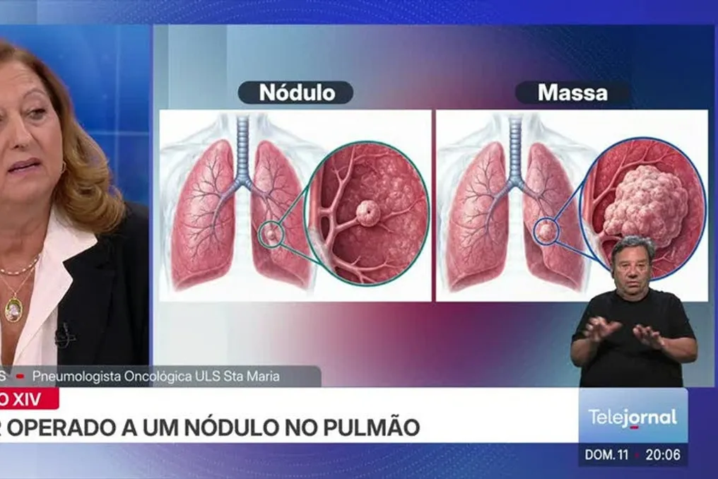 Papa Leo XIV anuncia cirurgia iminente nos pulmões