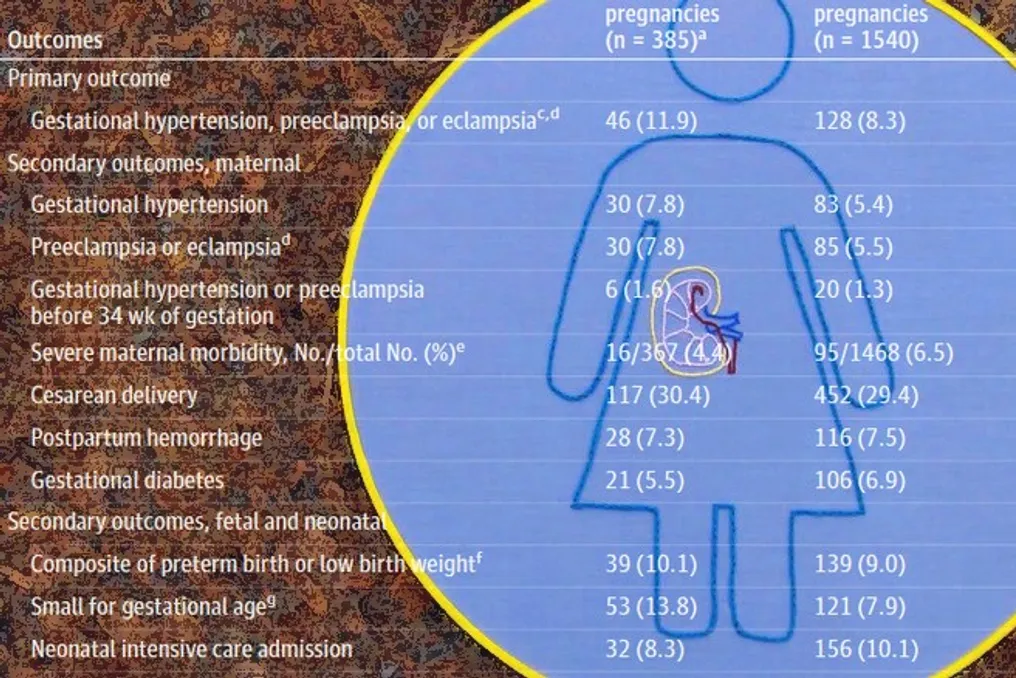 Estudo revela risco aumentado de distúrbios hipertensivos na gravidez em doadoras de rim